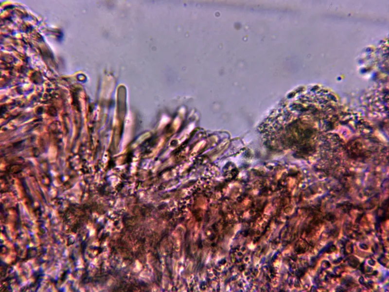 Byssomerulius corium 10 - Basidios tetrasporicos